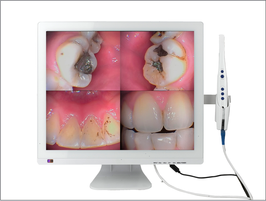 M-998 WIFI Intraoral Camera+19 inch LED monitor(Monitor all-in-one)