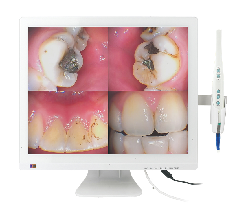 M-978V  17 inch screen+intra oral camera (all in one)