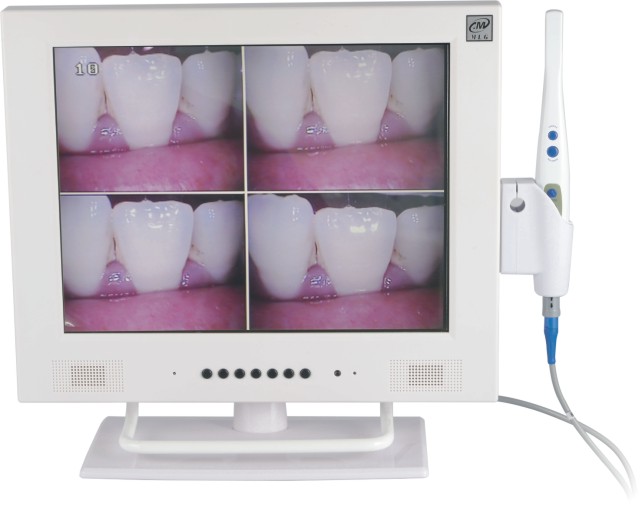M-958A+CF-687AHD WIFI Intraoral Camera+15 inch Monitor (all-in-one)