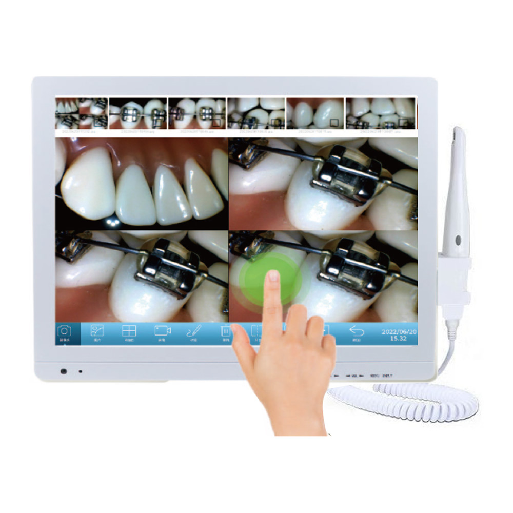 M-978PLUS Wi Fi Intelligent Zoom 17 inch Touchscreen Oral Observation ...